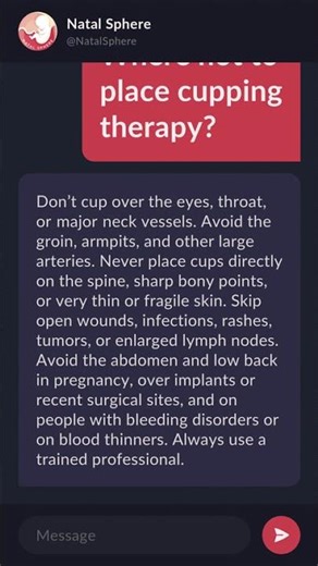Where not to place cupping therapy?