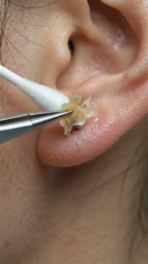 The Most Satisfying Ear Piercing Cleaning Ever! 🤯