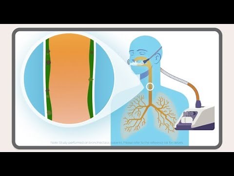 myAirvo™ 2：加温加湿ネーザルハイフローシステム