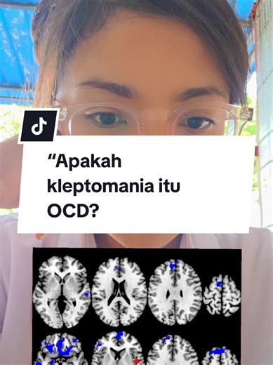 Imaging menunjukkan: 🧠 Orbitofrontal cortex & anterior cingulate terlibat Tapi pola aktivasi lebih dominan di reward system dibanding OCD. OCD = cemas → kompulsi Kleptomania = dorongan impuls → reward Bedanya di ‘tujuan otaknya’. #OCDvsKlepto #Neuropsikiatri #BrainFacts 📚 Daftar Pustaka Chamberlain SR et al. (2008). Neurocircuitry of OCD and impulse control. Biological Psychiatry Grant JE et al. (2006). Impulse control disorders review. Journal of Clinical Psychiatry Fineberg NA et al. (2010).