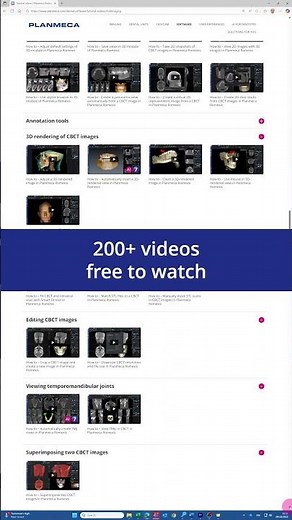 Did you know there are over 200 Planmeca Romexis® tutorial videos available?