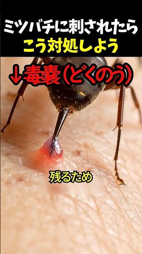 ミツバチに刺されたらこう対処しよう