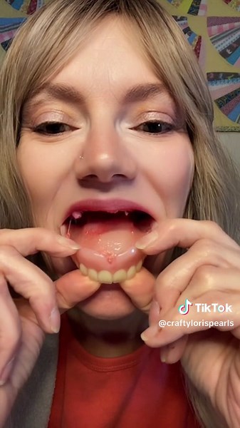 Mediocre Stringy Denture Glue: A Review