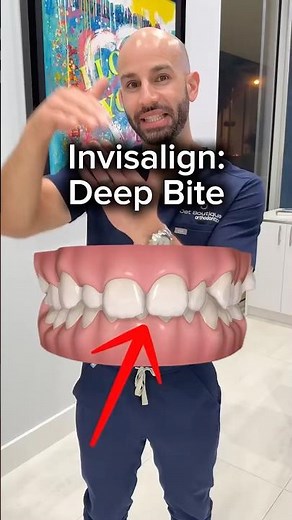 How we use Invisalign to fix this deep bite.