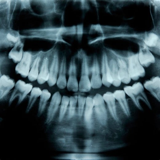 Humans Have a Third Set of Teeth. New Medicine May Help Them Grow