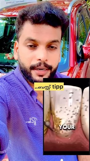 ‎محمد شريف‎ on Instagram: "🦷 മഞ്ഞ കറ മാറി wait കളർ കിട്ടും👀👆🏻💯"
