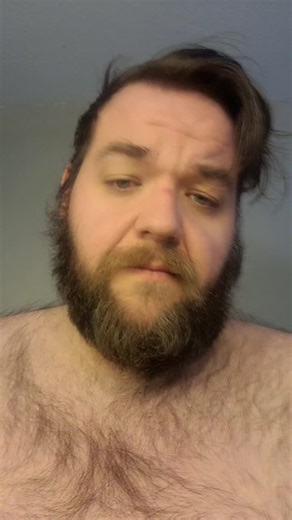 I never really notice the difference until I go back to before videos #bariatricsurgery #weightlossprogress #healthjourney