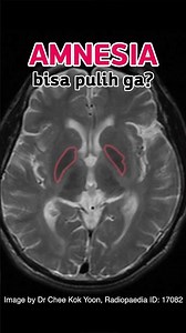 Amnesia and How to Recover Lost Memories