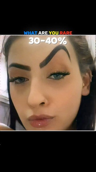 How Are You Rare 😨