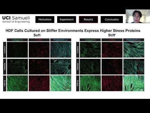 Understanding How Tissue Stiffness Drives Fibroblast Activation in Disease