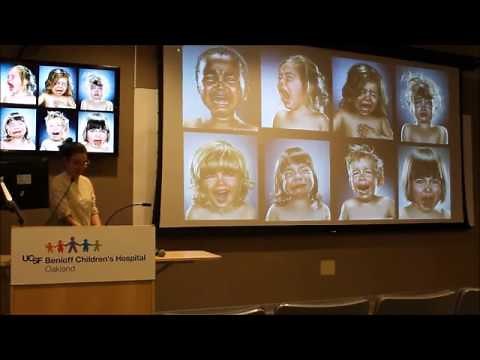 Emergence Delerium in Anesthesia - Rosalyn Brewer, MD, PhD