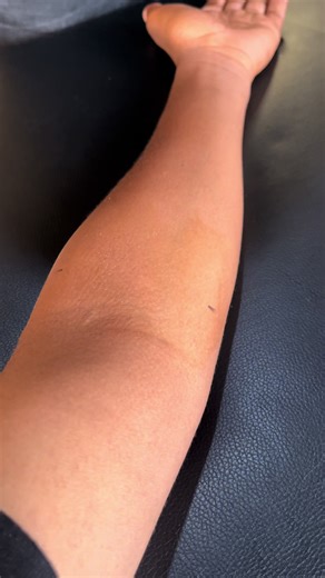 Dealing with Itches: Itch Relief Tips