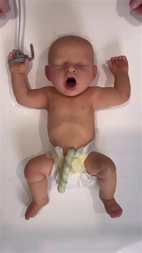 15K views · 148 reactions | A really good question on neonatal intubation with Sush Prusty #paramedicstudent #emtstudent #emtschool #emt #emtlife #paramedic #paramedicschool #paramedicos #paramediclife #paramedicscience #paramedical | Master Your Medics | Facebook