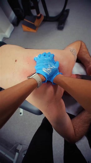 How to relieve back pain? Back pain often develops from muscle imbalances, stiffness, poor posture, or repeated strain over time. Physical therapy focuses on improving spinal mobility, strengthening supporting muscles, and correcting movement patterns that overload the back. This approach reduces pain, improves function, and helps prevent future flare-ups. #physicaltherapy #recovery #backpain