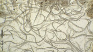 A microscopic view of roundworms nematodes, Steinernema, at 100 times magnification