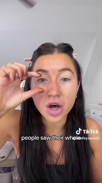 Discovering Ptosis: A Fascinating Journey