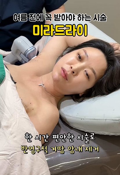 미라드라이 시술로 겨드랑이 다한증 개선하기