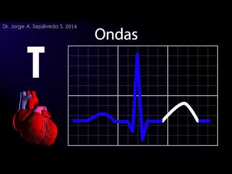 Electrocardiografía Básica (Parte 1/4)