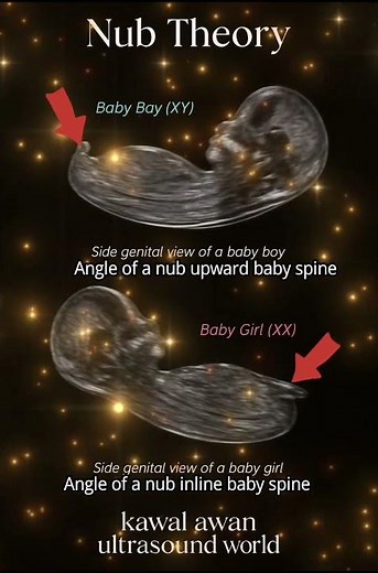 Nub Theory Gender Prediction 👶 | Boy or Girl? #ultrasound #pregnant