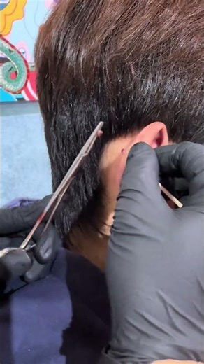 Emergency! Baby’s Ear Plug Stuck – Step by Step Removal