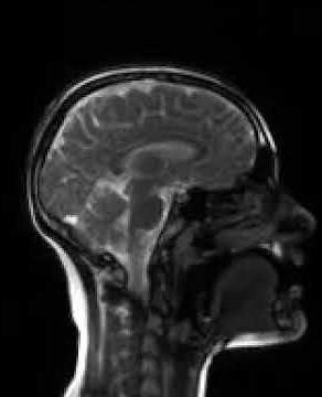 realtime MRI of speech