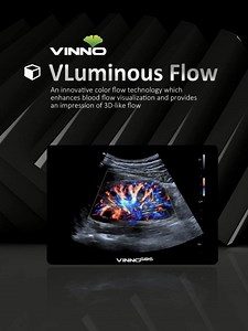 The VLuminous Flow Imaging technology has super stereoscopic 3D-like perspective, which delivers intuitive, vivid and three-dimensional visualization of blood flow. #VINNO #VINNOG86 #VLuminous Flow | VINNO Ultrasound