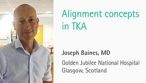 Alignment 4 Function 3/8: Clinical Experience of Mechanical vs. Non-mechanical Alignment with CAS - 1/2: Alignment Concepts in TKA