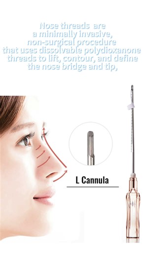 Nose Threads#Rhinoplasty #NonSurgicalProcedure #NoseJob #AestheticScience