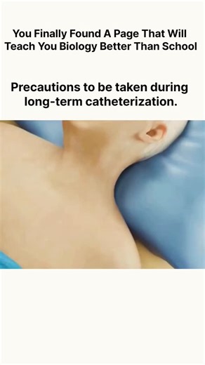 explaining. biology on Instagram: "Long-Term Catheter Care Guidelines Long-term catheterization requires careful daily care to prevent infections and complications. Hygiene is the first priority. Always wash hands before and after touching the catheter, and clean the catheter area daily with mild soap and water. Keep the catheter and surrounding skin dry and irritation-free. Proper Maintenance and Drainage Positioning: Ensure the drainage bag is always positioned below bladder level to prevent u