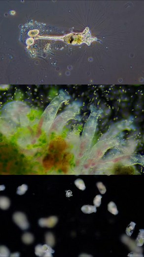 Three different genus of rotifers.🔬🦠 . . . #science #biology #microscopy | Science into Images