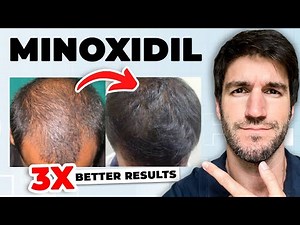 10 Things I Wish People Knew About Minoxidil (Before Quitting)
