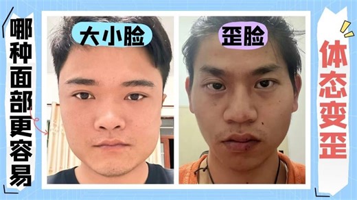 大小脸面部不对称，哪种脸型更容易产生体态歪斜！这个视频给你讲清楚