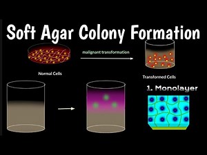 Soft Agar Colony Formation Assay | Identify Inhibitors Of Tumor | 96-Well Cell Transformation Assays