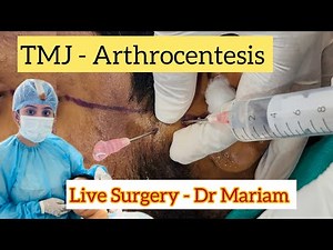 TMJ Arthrocentesis💉Two Needle Technique | Live Surgery| Step By Step | Complication