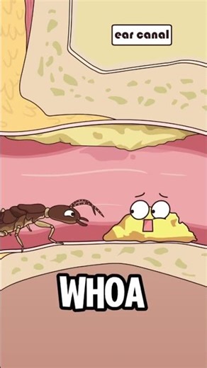 How Earwax Protects Your Ear 😱👂 Cartoon Explains Dust, Germs & Cleaning | Funny Medical Animation