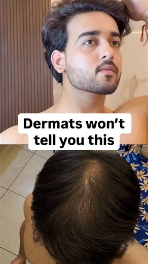 These scalp exercises for hair growth focus on blood circulation, scalp mobility, and follicle stimulation, things oils and serums can’t fix alone. No oil. No tools. Just your fingers. Do this daily for 5–10 minutes for better scalp health and stronger roots. This routine helps with: hair fall control, weak roots, poor blood flow, tight scalp, stress-related shedding. Works best when combined with proper protein intake, sleep, and consistency. Save this. Do it daily. Stay patient. #scalpexercise