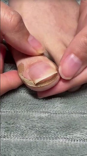 What to do when toenails grow into the flesh #nailpiercingflesh #ingrowntoenail #footcare 📌