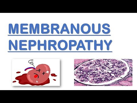 Membranous Nephropathy | Nephrotic Syndrome | Made Easy