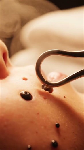 “Watching Every Pore Clear in One Perfect Pass”