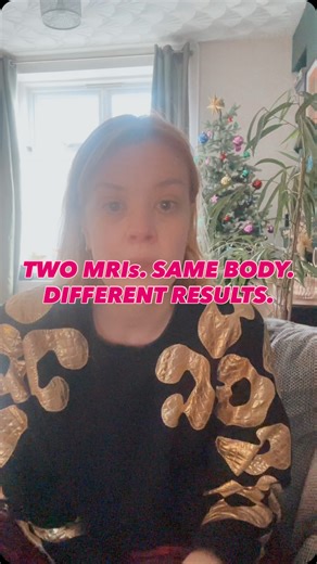 endo a ni on Instagram: "Two MRIs. Same body. Completely different results. My NHS MRI came back “normal” — no endometriosis, no adenomyosis. But later, my private MRI with an endometriosis specialist, showed an adenomyoma, an endometrioma, and recurring endometriosis. This isn’t about better machines — it’s about who is trained to read them. MRIs are often good at spotting deep infiltrating endometriosis (DIE), but they don’t always pick up everything, especially smaller or superficial disease.