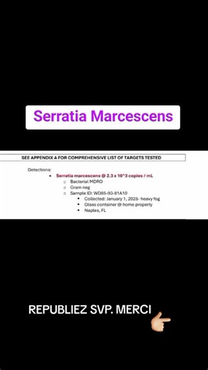 Serratia marcescens et ses dangers pour la santé