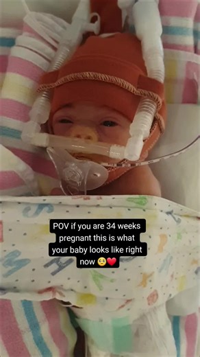 Experience the Beauty of Your 34-Week Baby's Development