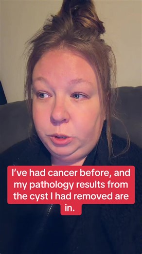 Understanding Epidermal Sebaceous Cysts: My Journey