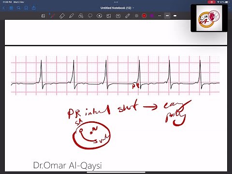 ECG interpretation the basics │ اساسيات تخطيط القلب