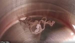 Shock As Doctors Remove Live Six-Inch Worm From A Woman's Brain During Operation (Video)