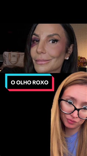 Ivete Sangalo e seu Olho Roxo: Mistérios Sobrenaturais