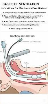MECHANICAL VENTILATION MADE EASY | MV SERIES PART 1