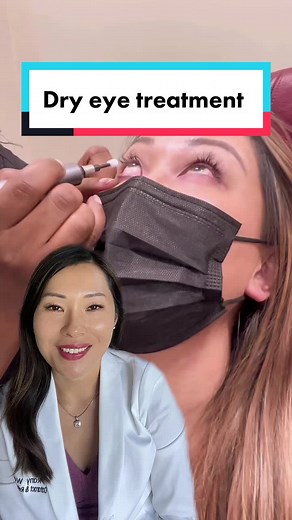 #duet with @tiffanymoonmd This is the blephex ilux treatment! Great procedure for treating dry eye disease caused by meibomian gland dysfunction. #eyetreatment #medicaltiktok #learnontiktok #ophthalmology #fyp