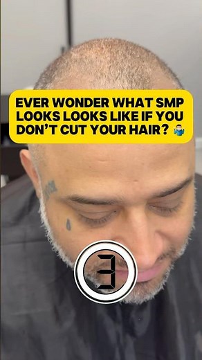 ➡️ Wonder What Happens If You Let Your Hair Grow After SMP? | Real Client Example + Free Guide