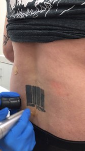 70K views · 80 reactions | £20 off your treatment. Book your free...